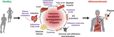 Role of the Nuclear Receptor Corepressor 1 (NCOR1) in Atherosclerosis and Associated Immunometabolic Diseases